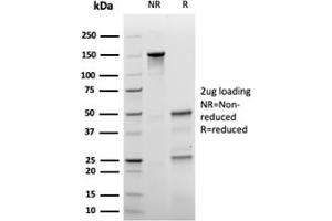 SDS-PAGE Analysis Purified p27 Recombinant Mouse Monoclonal Antibody (rKIP1/1356). (Rekombinanter CDKN1B Antikörper)