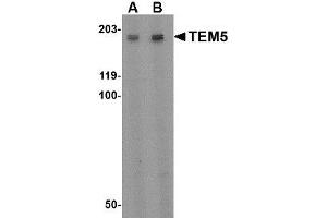 Image no. 1 for anti-G Protein-Coupled Receptor 124 (GPR124) (Internal Region) antibody (ABIN1493615) (GPR124 Antikörper  (Internal Region))