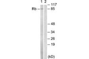 Western Blotting (WB) image for anti-Retinoblastoma Protein (Rb Protein) (AA 771-820) antibody (ABIN2888773) (Retinoblastoma Protein (Rb) Antikörper  (AA 771-820))