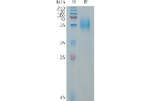 Human CD79A Protein, hFc Tag on SDS-PAGE under reducing condition. (CD79a Protein (AA 33-143) (Fc Tag))