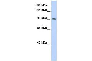 SCUBE2 antibody used at 1 ug/ml to detect target protein. (SCUBE2 Antikörper  (C-Term))