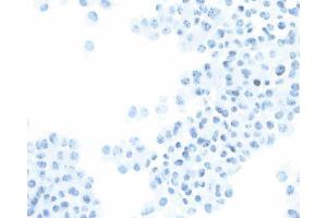 Immunohistochemical staining of SV40 large T, small t antigen. (SV40 Large T and Small Ts Antikörper)