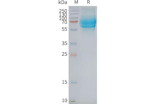 Glucagon Receptor Protein (GCGR)