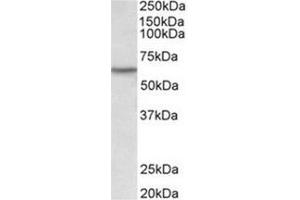 AP31924PU-N LCK antibody staining of Human Thymus lysate at 0. (LCK Antikörper  (Internal Region))