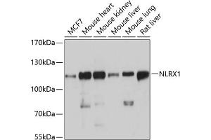 Western blot analysis of extracts of various cell lines, using NLRX1 antibody  at 1:3000 dilution. (NLRX1 Antikörper  (AA 87-360))