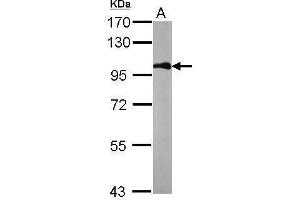 Western Blotting (WB) image for anti-Catenin (Cadherin-Associated Protein), beta 1, 88kDa (CTNNB1) (N-Term) antibody (ABIN2855042)