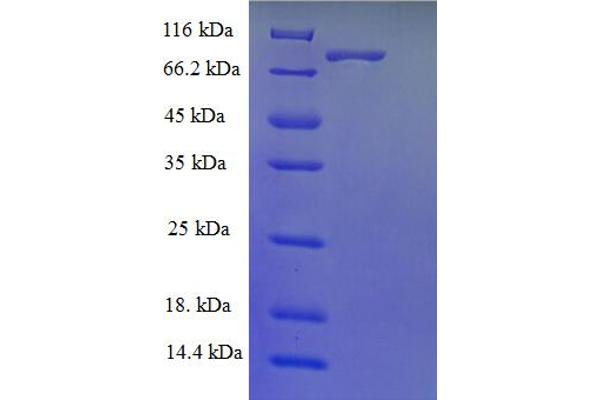 FAM175B Protein (AA 1-415, full length) (GST tag)