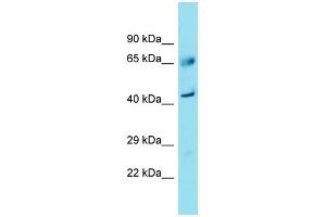 Western Blotting (WB) image for anti-Family with Sequence Similarity 83, Member A (FAM83A) (C-Term) antibody (ABIN2791509) (FAM83A Antikörper  (C-Term))