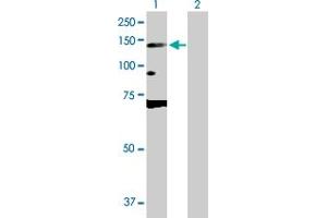 Western Blot analysis of DNMT3A expression in transfected 293T cell line by DNMT3A MaxPab polyclonal antibody. (DNMT3A Antikörper  (AA 1-912))