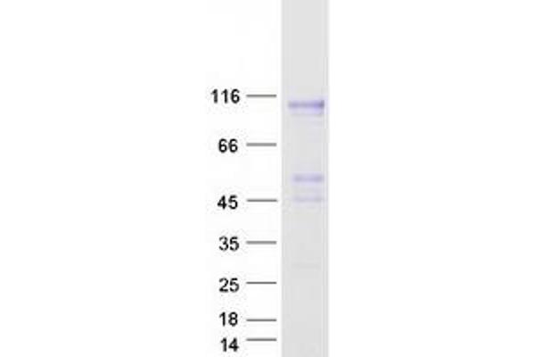 CPXM1 Protein (Myc-DYKDDDDK Tag)