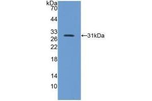 Detection of Recombinant ITGb5, Mouse using Polyclonal Antibody to Integrin Beta 5 (ITGb5) (Integrin beta 5 Antikörper  (AA 136-378))