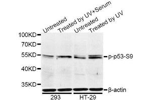 Western blot analysis of extracts of 293 and HT-29 cells, using Phospho-p53-S9 antibody. (p53 Antikörper  (pSer9))