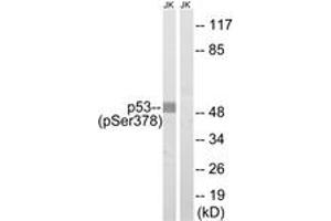 Western blot analysis of extracts from Jurkat cells treated with UV 15', using p53 (Phospho-Ser378) Antibody. (p53 Antikörper  (pSer378))