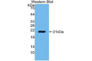 Western Blotting (WB) image for anti-POTE Ankyrin Domain Family, Member G (POTEG) (AA 177-330) antibody (ABIN1980492) (POTEG Antikörper  (AA 177-330))