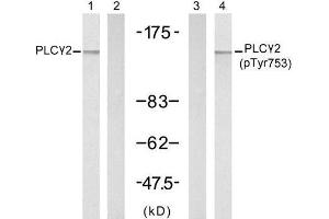 Western blot analysis of extracts from A431 cells, untreated or treated with EGF (200ng/ml, 5min), using PLCγ2 (Ab-753) antibody (E021186, Lane 1 and 2) and PLCγ2 (phospho-Tyr753) antibody (E011175, Lane 3 and 4). (Phospholipase C gamma 2 Antikörper)