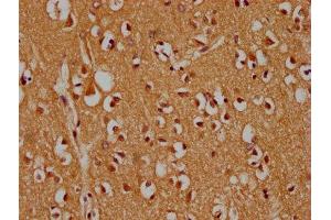 IHC image of ABIN7159994 diluted at 1:300 and staining in paraffin-embedded human brain tissue performed on a Leica BondTM system. (MAPK14 Antikörper  (AA 2-258))