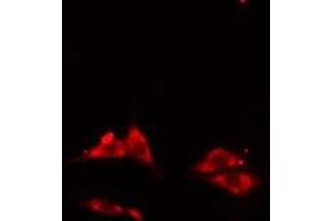 ABIN6275601 staining HepG2 cells by IF/ICC. (Sorting Nexin 3 Antikörper  (Internal Region))