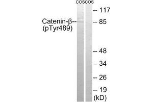 Western Blotting (WB) image for anti-Catenin, beta (CATNB) (pTyr489) antibody (ABIN1847544) (beta Catenin Antikörper  (pTyr489))