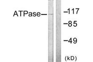 Western blot analysis of extracts from 293 cells, treated with PMA 125ng/ml 30', using ATPase (Ab-16) Antibody. (ATPase Antikörper  (AA 5-54))