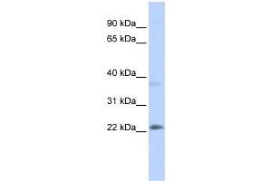 WB Suggested Anti-SRY Antibody Titration:  0. (SRY Antikörper  (Middle Region))