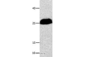 Western blot analysis of Huamn cervical cancer tissue , using BCL2L1 Polyclonal Antibody at dilution of 1:300 (BCL2L1 Antikörper)