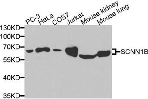 Western blot analysis of extracts of various cells, using SCNN1B antibody. (SCNN1B Antikörper)