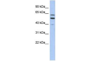 WB Suggested Anti-TMCC1 Antibody Titration:  0. (TMCC1 Antikörper  (Middle Region))