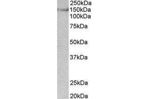 Western Blotting (WB) image for anti-Synaptic Ras GTPase Activating Protein 1 (SYNGAP1) (Internal Region) antibody (ABIN2464964) (SYNGAP1 Antikörper  (Internal Region))