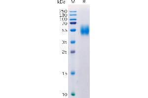 Human MICA Protein, His Tag on SDS-PAGE under reducing condition. (MICA Protein (AA 24-307) (His tag))