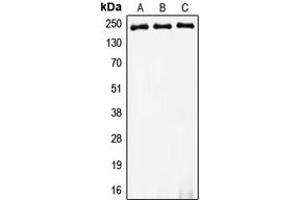 Western blot analysis of Myosin 8 expression in HeLa (A), SP2/0 (B), PC12 (C) whole cell lysates. (MYH8 Antikörper  (Center))