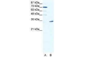 Western Blot showing MAGEA9 antibody used at a concentration of 1-2 ug/ml to detect its target protein. (MAGEA9 Antikörper  (N-Term))