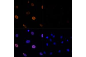 Immunofluorescence analysis of C6 cells using Acetyl-Histone H3-K56 Rabbit pAb (ABIN7267674) at dilution of 100 (40x lens). (Histone 3 Antikörper  (H3K56))