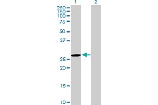 DUPD1 Antikörper  (AA 1-220)