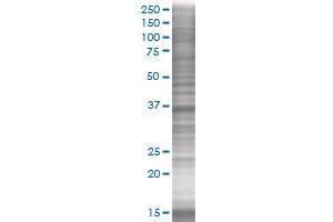 FBP1 transfected lysate. (FBP1 293T Cell Transient Overexpression Lysate(Denatured))