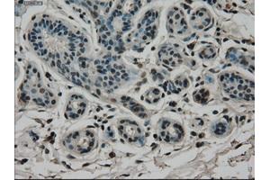 Immunohistochemical staining of paraffin-embedded breast tissue using anti-CD4 mouse monoclonal antibody. (CD4 Antikörper)