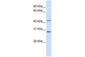 RPL3 antibody used at 1 ug/ml to detect target protein. (RPL3 Antikörper  (N-Term))