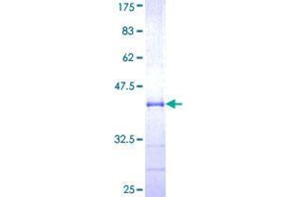 TBL1XR1 Protein (AA 81-178) (GST tag)