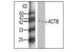 Image no. 1 for anti-Actin, beta (ACTB) antibody (ABIN791504) (beta Actin Antikörper)