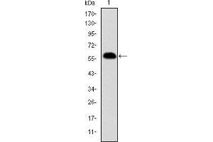 Western Blotting (WB) image for anti-Prohibitin (PHB) antibody (ABIN969353)