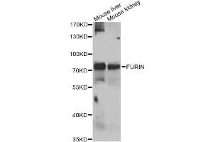 Western blot analysis of extracts of various cell lines, using FURIN antibody (ABIN4903706) at 1:1000 dilution. (FURIN Antikörper)