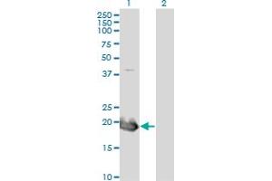 Western Blot analysis of HAND2 expression in transfected 293T cell line by HAND2 monoclonal antibody (M08), clone 4B11. (HAND2 Antikörper  (AA 135-216))