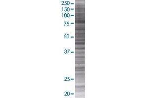 ZBTB48 transfected lysate. (HKR3 293T Cell Transient Overexpression Lysate(Denatured))