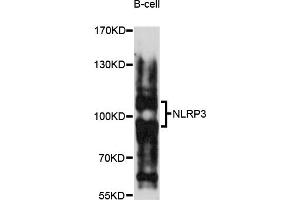 Western blot analysis of extracts of B-cell cells, using NLRP3 antibody (ABIN5973297) at 1/1000 dilution. (NLRP3 Antikörper)