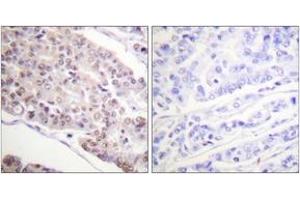 Immunohistochemistry (IHC) image for anti-Histone H4 (acLys8) antibody (ABIN2890733) (Histone H4 Antikörper  (acLys8))