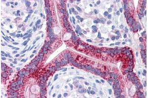 Human Small Intestine: Formalin-Fixed, Paraffin-Embedded (FFPE) (OAT Antikörper)