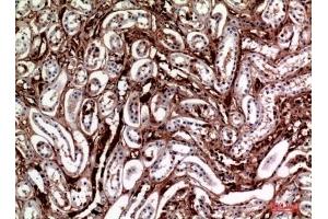 Immunohistochemical analysis of paraffin-embedded human-kidney, antibody was diluted at 1:100. (M-CSF/CSF1 Antikörper  (C-Term))