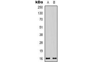 Western blot analysis of CD235a expression in HEK293T (A), 22RV1 (B) whole cell lysates. (CD235a/GYPA Antikörper)