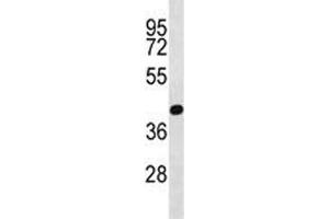 PRMT6 antibody western blot analysis in NCI-H460 lysate (PRMT6 Antikörper  (AA 19-48))