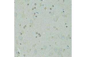 Immunohistochemistry of paraffin-embedded rat brain using GTF2H2C antibody (ABIN1876445) at dilution of 1:100 (40x lens). (GTF2H2C Antikörper)