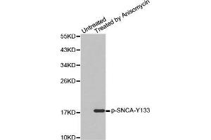 Western blot analysis of extracts from C2C12 cells, using Phospho-SNCA-Y133 antibody. (SNCA Antikörper  (pTyr133))